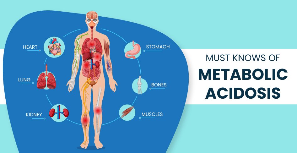 Metabolic Acidosis: Causes, Symptoms, Diagnosis, and Treatment Explained