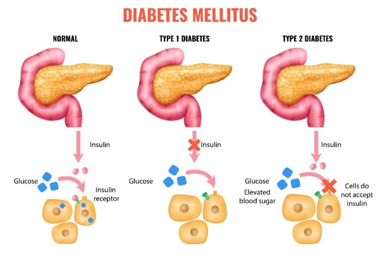 Role of Insulin Resistance in Metabolic Health