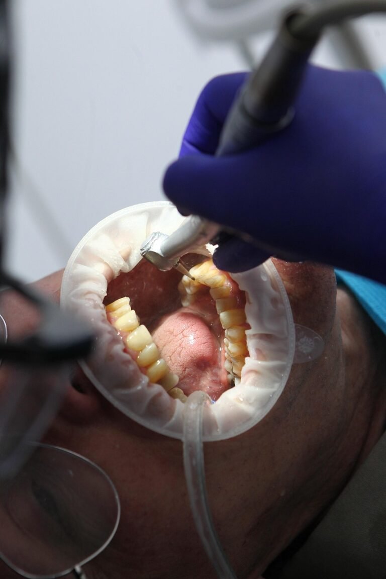 Why is Oral Hygiene Important