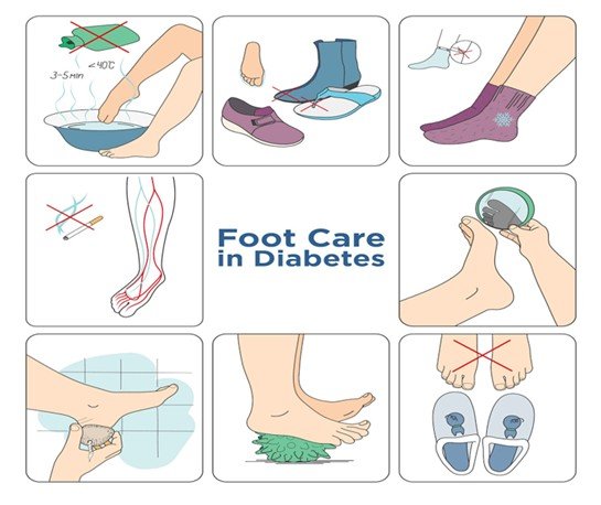 Essential Foot Care Practices to Prevent Ulcers