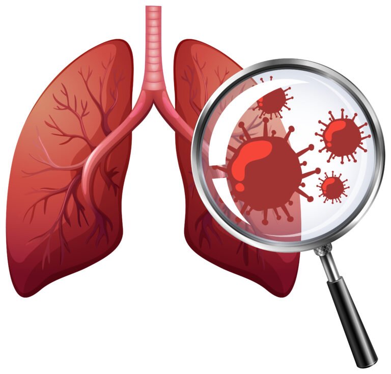 Is Pneumonia Contagious?