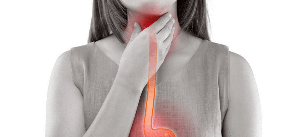 Over-the-Counter (OTC) Solutions of Sore Throat